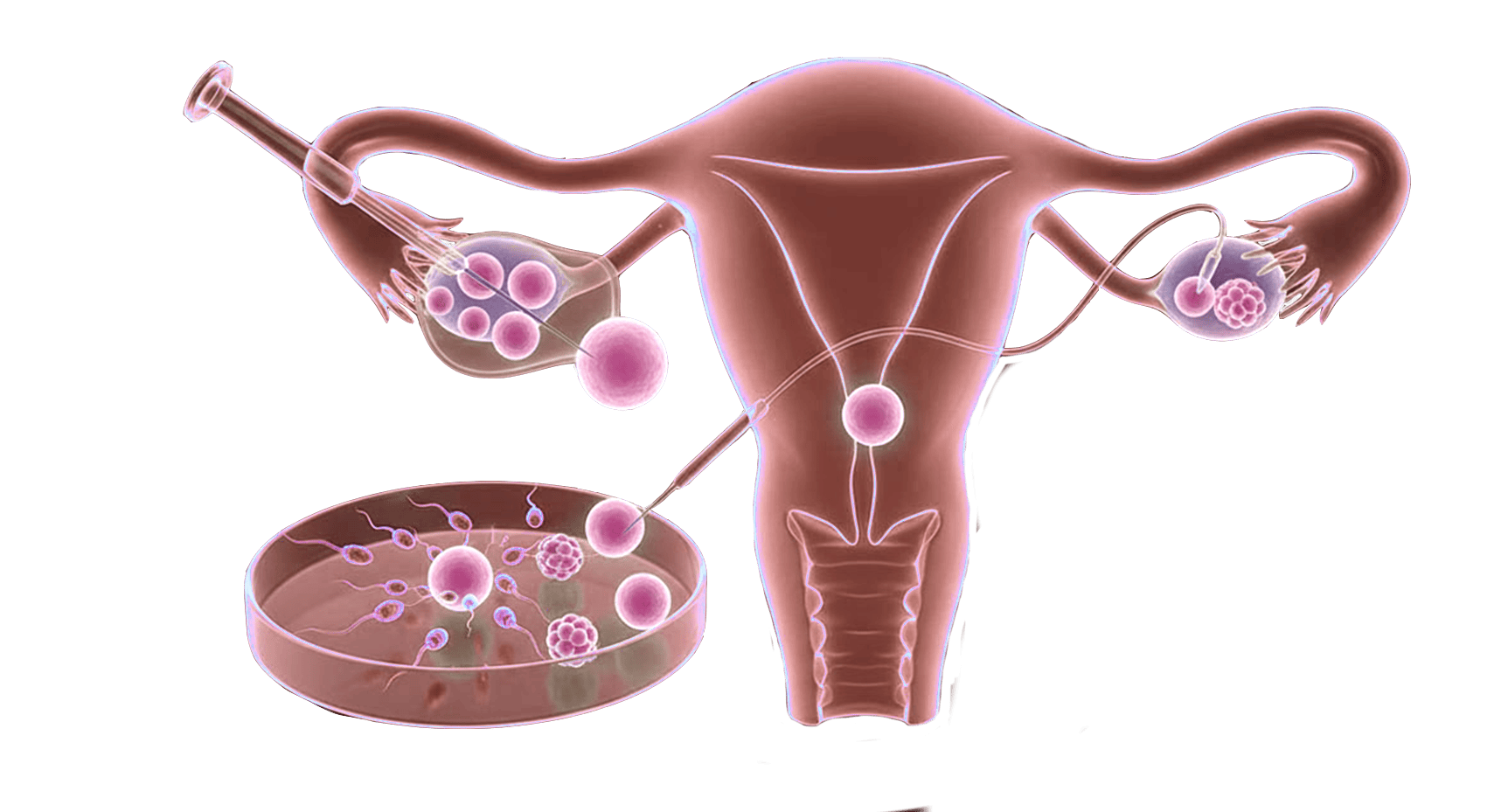 Advanced Treatment Icon